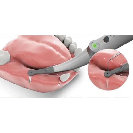 Spotter – Smart Implant Detector