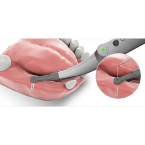 Spotter – Smart Implant Detector